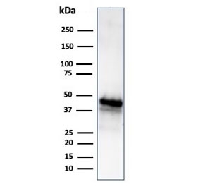 Western blot testing of human Y79 cell lysate using mouse monoclonal GLUL antibody (clone GLUL/6604). Predicted molecular weight ~42 kDa.
