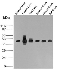GLUL Antibody Multi-Tissue WB. Western blot analysis of human liver, mouse liver, rat liver, human brain, mouse brain, and rat brain lysates using GLUL Antibody mouse monoclonal clone GLUL/6604. A prominent band is detected at approximately 42-45 kDa across liver and brain tissue samples, consistent with the predicted molecular weight of Glutamate-ammonia ligase / GLUL, a glutamine-synthesizing enzyme involved in nitrogen metabolism and regulation of glutamate homeostasis. The broader and more intense signal observed in mouse liver lysate likely reflects elevated GLUL expression and tissue-specific post-translational heterogeneity commonly observed in metabolically active hepatic tissue.