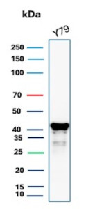 GLUL Antibody Y79 WB. Western blot analysis of Y79 cell lysate using GLUL Antibody mouse monoclonal clone GLUL/6604. A strong band is detected at approximately 42-45 kDa, consistent with the predicted molecular weight of Glutamate-ammonia ligase / GLUL, a glutamine-synthesizing enzyme involved in nitrogen metabolism and regulation of glutamate homeostasis. Faint lower molecular weight bands beneath the primary signal likely represent minor degradation products or partially processed GLUL species commonly observed in cell lysates.