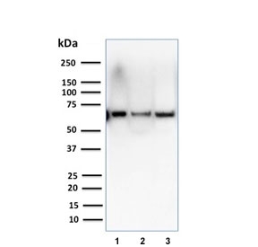 CSTF2T Antibody Breast Cancer Cell Line WB. Western blot analysis of human breast and melanoma cancer cell lysates using clone PCRP-CSTF2T-1A3. Lane 1: T47-D, Lane 2: SK-BR-3, Lane 3: A375. A band is detected at approximately 64 kDa, consistent with the predicted molecular weight of Cleavage stimulation factor subunit 2 tau / CSTF2T. The observed expression pattern supports the role of CSTF2T in RNA cleavage and polyadenylation pathways associated with post-transcriptional gene regulation in transformed cell populations.