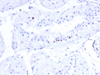 CSTF2T Antibody Human Testis IHC. Immunohistochemistry analysis of FFPE human testis tissue stained with clone PCRP-CSTF2T-1A3. Scattered germ cell populations within seminiferous tubules display distinct nuclear HRP-DAB brown staining, aligning with the known testis-enriched expression profile of Cleavage stimulation factor subunit 2 tau / CSTF2T and its involvement in germ cell differentiation and spermatogenesis-associated RNA processing. Interstitial stromal cells show minimal background signal. HIER: boil tissue sections in pH 9 10mM Tris with 1mM EDTA for 20 min and allow to cool before testing.