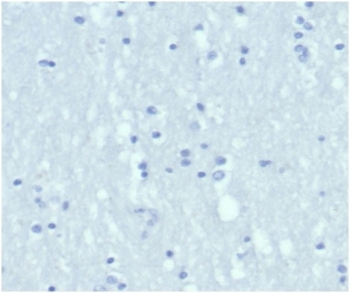 Negative control: IHC staining of FFPE human brain tissue using Keratin 6A antibody (clone KRT6/3997R) at 2ug/ml in PBS for 30min RT. HIER: boil tissue sections in pH 9 10mM Tris with 1mM EDTA for 20 min and allow to cool before testing.