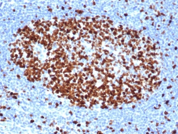 IHC staining of FFPE human tonsil tissue with recombinant Ki67 antibody (clone rMKI67/6499). HIER: boil tissue sections in pH 9 10mM Tris with 1mM EDTA for 20 min and allow to cool before testing.