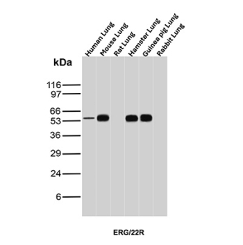 ERG Antibody Tissue WB. Western blot analysis of human lung, mouse lung, rat lung, hamster lung, guinea pig lung, and rabbit lung tissue lysates using ERG antibody (clone ERG/22R) detects a band at approximately 50-55 kDa, consistent with the predicted molecular weight of the ERG transcription factor, with comparable expression observed across species.