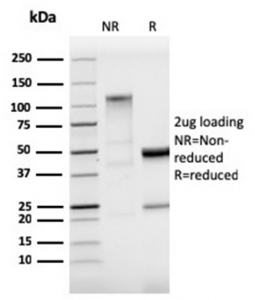 SDS-PAGE analysis of purified, BSA-free StAR Antibody Recombinant Rabbit MAb STAR/3915R as confirmation of integrity and purity.