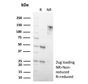 WIPI2 Antibody SDS-PAGE Integrity Analysis. SDS-PAGE analysis of purified, BSA-free WIPI2 Antibody / Autophagosome Formation Protein Antibody clone 2A2 demonstrates the expected immunoglobulin banding profile under reduced and non-reduced conditions, supporting antibody integrity and preparation purity. Reduced conditions (R) show characteristic heavy and light chain migration patterns, while non-reduced conditions (NR) demonstrate intact immunoglobulin species. This widely utilized clone 2A2 antibody has been reported in published studies involving autophagosome formation, phagophore assembly, and autophagy-associated signaling pathways.