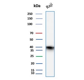 Western blot testing of human Raji cell lysate with CD40 antibody. Expected molecular weight is 30-45 kDa depending on glycosylation level.