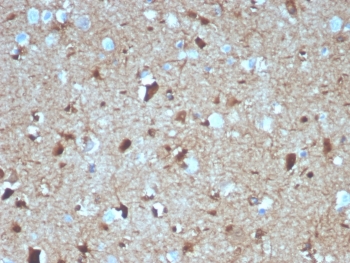 IHC staining of FFPE human brain tissue with S100B antibody (clone S100B/4139). HIER: boil tissue sections in pH 9 10mM Tris with 1mM EDTA for 20 min and allow to cool before testing.