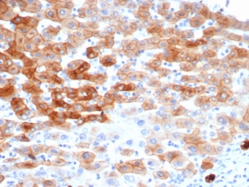 KRT8 Antibody Human Colon IHC. Immunohistochemical staining of FFPE human colon tissue using recombinant KRT8 Antibody (clone rKRT8/6471) demonstrates strong membranous and cytoplasmic HRP-DAB brown staining within epithelial cells. The staining pattern is consistent with expression of Cytokeratin 8 (KRT8/CK8), a type II intermediate filament protein widely expressed in simple epithelial tissues where it contributes to cytoskeletal organization, epithelial integrity, and cellular stress-response pathways. KRT8 immunoreactivity highlights epithelial cell morphology and tissue architecture within the colon while surrounding stromal elements exhibit comparatively limited staining. HIER: boil tissue sections in pH 9 10 mM Tris with 1 mM EDTA for 20 minutes and allow to cool before testing.