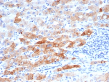 KRT8 Antibody Human Colon Tissue IHC. Immunohistochemical staining of FFPE human colon tissue using recombinant KRT8 Antibody (clone rKRT8/6471) demonstrates strong cytoplasmic and membranous HRP-DAB brown staining throughout epithelial cell populations. The staining pattern is consistent with expression of Cytokeratin 8 (KRT8/CK8), a type II intermediate filament protein that supports epithelial cytoskeletal organization, structural integrity, and cellular stress-response functions. KRT8 immunoreactivity highlights epithelial morphology and tissue architecture within the colon, while adjacent stromal and lymphoid elements show comparatively limited staining. HIER: boil tissue sections in pH 9 10 mM Tris with 1 mM EDTA for 20 minutes and allow to cool before testing.