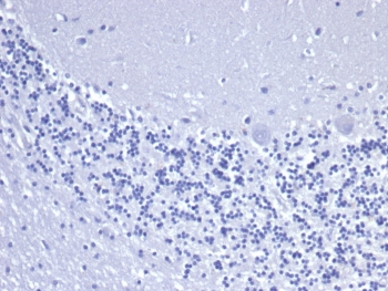 KRT8 Antibody Human Brain Negative Control IHC. Immunohistochemical staining of FFPE human brain tissue using recombinant KRT8 Antibody (clone rKRT8/6471) under negative control conditions demonstrates an absence of specific HRP-DAB staining, with only hematoxylin-counterstained nuclei visible throughout the tissue section. The lack of detectable signal confirms minimal nonspecific background staining and supports the specificity of the immunohistochemical procedure. Cytokeratin 8 (KRT8/CK8) is an epithelial intermediate filament protein that is not expected to be broadly expressed within normal brain parenchyma. Antibody incubation was performed in PBS for 30 minutes at room temperature. HIER: boil tissue sections in pH 9 10 mM Tris with 1 mM EDTA for 20 minutes and allow to cool before testing.