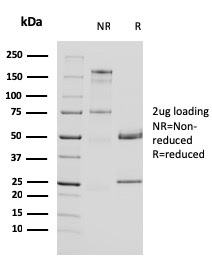 SDS-PAGE analysis of purified, BSA-free Uroplakin 1A antibody (clone UPK1A/2924) as confirmation of integrity and purity.