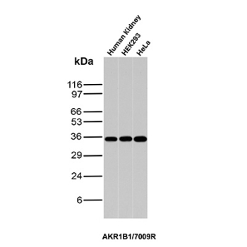 Recombinant AKR1B1 Antibody Tissue and Cell Line WB. Western blot analysis of human kidney tissue together with HEK293 and HeLa cell lysates using recombinant AKR1B1 Antibody clone AKR1B1/7009R. Strong bands are detected near approximately 35-40 kDa across all samples, consistent with the predicted molecular weight of Aldose reductase / AKR1B1, an oxidative stress-associated aldo-keto reductase family enzyme involved in reactive aldehyde detoxification, glucose-responsive signaling, and polyol pathway-associated metabolic regulation.