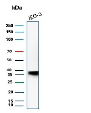 HLA-G Antibody HLAG/6686 Detection in JEG-3 Choriocarcinoma Cells WB. Western blot analysis of human JEG-3 placental choriocarcinoma cell lysate using HLA-G Antibody clone HLAG/6686. A strong immunoreactive band is detected at approximately 36-38 kDa, consistent with the expected molecular weight of HLA-G. The result demonstrates detection of endogenous HLA-G in JEG-3 cells, a trophoblast-derived cancer cell line commonly used to study HLA-G expression.