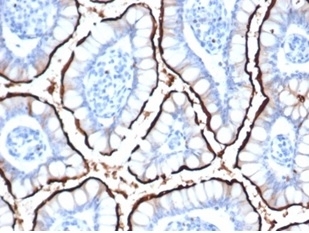 ACE2 Antibody Recombinant Rabbit MAb ACE2/6788R in human small intestine. Immunohistochemistry staining of FFPE human small intestine tissue using a recombinant rabbit monoclonal ACE2 antibody demonstrates membranous and cytoplasmic staining in intestinal epithelial cells lining the villi, consistent with the known epithelial expression pattern of Angiotensin-converting enzyme 2 (ACE2). The antibody ACE2 Antibody Recombinant Rabbit MAb ACE2/6788R was applied at 2 ug/ml for 30 min at room temperature following heat-induced epitope retrieval in pH 9 Tris-EDTA buffer. Brown chromogenic signal highlights ACE2-positive epithelial cells while surrounding stromal elements remain largely negative.
