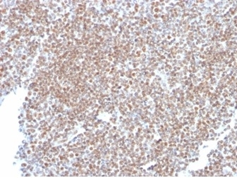 IHC staining of FFPE human tonsil tissue with SP100 antibody (clone PCRP-SP100-1B9) at 2ug/ml in PBS for 30min RT. HIER: boil tissue sections in pH 9 10mM Tris with 1mM EDTA for 20 min and allow to cool before testing.