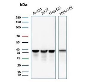 Western blot testing of human A431, 293T and HepG2 cell lysate and mouse NIH 3T3 cell lysate with PCNA antibody. Predicted molecular weight ~29 kDa, routinely observed at 29~36 kDa.