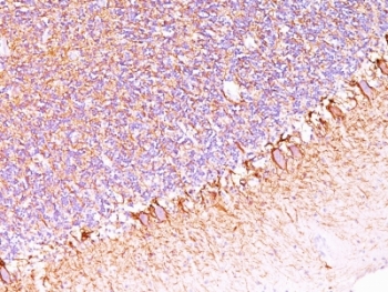 IHC: Formalin-fixed, paraffin-embedded human cerebellum stained with anti-Neurofilament antibody (SPM563).