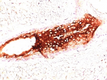 Cytokeratin 17 Antibody for FACS (clone SPM560) immunohistochemistry analysis of human skin tissue. Immunohistochemistry of FFPE human skin demonstrates strong HRP-DAB brown cytoplasmic staining in epithelial structures using Cytokeratin 17 Antibody for FACS (clone SPM560). The staining highlights epithelial cells consistent with the known expression of Cytokeratin 17 (CK17 / KRT17), an epithelial intermediate filament protein enriched in basal epithelial compartments and epithelial appendages of skin. Adjacent stromal tissue shows minimal staining, supporting epithelial cell-associated CK17 expression.