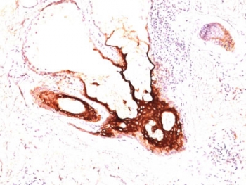 IHC: Formalin-fixed, paraffin-embedded human skin stained with Cytokeratin 17 antibody clone SPM560.