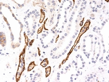IHC testing of FFPE human kidney transplant with Complement 4d antibody (SPM545). Required HIER: boil tissue sections in 10mM Tris with 1mM EDTA, pH 9.0, for 10-20 min followed by cooling at RT for 20 minutes.