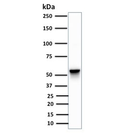VIM Antibody Clone SPM576 WB. Western blot testing of VIM Antibody Clone SPM576 and human A375 cell lysate. Predicted molecular weight ~58 kDa.