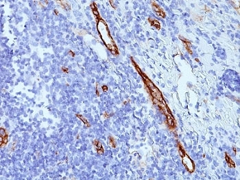 von Willebrand Factor Antibody / Endothelial Secretion Marker Antibody. Immunohistochemistry analysis of human tonsil tissue shows HRP-DAB brown staining of endothelial cells lining vascular channels within lymphoid tissue. The staining highlights vessel-associated endothelium with both luminal and cytoplasmic signal, consistent with VWF localization in storage granules and its release along the vascular surface. This pattern reflects endothelial secretion activity, with signal distribution indicating intracellular storage and extracellular deposition along vessel linings. Clone SPM577 enables visualization of vascular structures together with secretion-associated VWF localization.