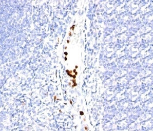Granulocyte Antibody Tonsil IHC. Immunohistochemistry testing of formalin-fixed, paraffin-embedded human tonsil stained with Granulocyte antibody (SPM250).