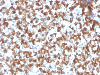 FSHB Antibody Recombinant Pituitary IHC. Immunohistochemistry staining of FFPE human pituitary tissue using recombinant monoclonal clone FSHb/2033R demonstrates extensive granular cytoplasmic HRP-DAB brown staining within anterior pituitary endocrine cell populations, consistent with Follicle stimulating hormone beta / FSHB localization in hormone-secreting gonadotroph cells. The dense punctate staining pattern reflects accumulation of secretory hormone-associated protein within pituitary endocrine compartments. HIER: boil tissue sections in pH 9 10mM Tris with 1mM EDTA for 20 min and allow to cool before testing.