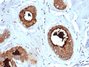 Mammaglobin A Antibody Recombinant Mouse MAb (clone rMGB/6619) immunohistochemistry of human lactating breast tissue. FFPE human lactating breast tissue was stained with Mammaglobin A Antibody Recombinant Mouse MAb (clone rMGB/6619). HRP-DAB brown chromogenic signal highlights strong cytoplasmic staining in secretory epithelial cells lining mammary glandular structures and luminal secretions, consistent with elevated expression of Mammaglobin A / SCGB2A2 in lactating breast epithelium, while surrounding stromal cells show minimal staining. Heat-induced epitope retrieval was performed by boiling tissue sections in pH 9 10mM Tris with 1mM EDTA for 20 minutes followed by cooling prior to staining.