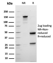 SDS-PAGE analysis of purified, BSA-free Mammaglobin A Antibody Recombinant Mouse MAb clone rMGB/6619) as confirmation of integrity and purity.