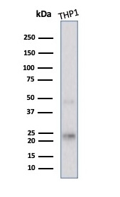 Western blot testing of human THP1 cell lysate using recombinant LMO2 antibody (clone rLMO2/1971). Predicted molecular weight ~25 kDa.