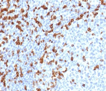CD7 Antibody for IHC. Immunohistochemistry analysis of CD7 / T-cell antigen CD7 in human tonsil tissue shows distinct HRP-DAB brown membranous staining of scattered lymphoid cells within interfollicular regions, consistent with CD7-positive T lymphocytes involved in immune activation, while surrounding areas display minimal background staining. Recombinant CD7 antibody clone rCD7/6387 was used following heat-induced epitope retrieval in pH 9 Tris-EDTA buffer, supporting its utility as a T cell activation marker in FFPE tissue sections.