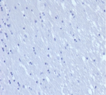 CD7 Antibody Negative Control. Immunohistochemistry analysis of CD7 / T-cell antigen CD7 in human brain tissue shows absence of HRP-DAB brown staining with only hematoxylin counterstain visible, consistent with expected lack of CD7 expression in non-lymphoid tissue and supporting antibody specificity. Recombinant CD7 antibody clone rCD7/6387 was applied at 2 ug/ml following heat-induced epitope retrieval in pH 9 Tris-EDTA buffer, serving as a negative tissue control for T cell activation marker detection in FFPE sections.