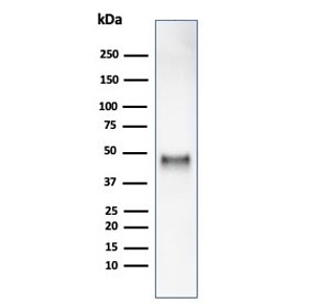 Western blot testing of human HCT116 cell lysate using Cyclin E1 antibody (clone rCCNE1/4936). Predicted molecular weight ~47 kDa.