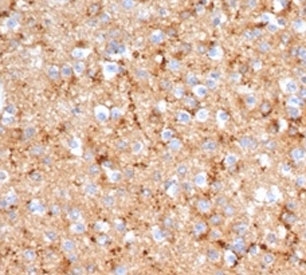 SYP Antibody Recombinant Mouse MAb Clone rSYP/6856. Immunohistochemistry analysis of FFPE human brain tissue shows widespread cytoplasmic HRP-DAB brown staining within neuronal cells and neuropil, consistent with Synaptophysin (SYP) localization in presynaptic vesicle membranes. The staining pattern highlights dense synaptic vesicle populations throughout neuronal processes and synapse-rich regions of brain tissue. Hematoxylin counterstain marks nuclei in blue. The recombinant mouse monoclonal SYP antibody clone rSYP/6856 was used to detect synaptic vesicle protein expression in human brain tissue. Heat-induced epitope retrieval was performed by boiling tissue sections in pH 9 10mM Tris with 1mM EDTA for 20 minutes followed by cooling prior to staining.