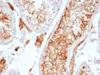 INHA Antibody Rabbit Monoclonal (clone INHA/6598R) IHC staining of human testis. Immunohistochemistry analysis of FFPE human testis tissue using INHA Antibody Rabbit Monoclonal (clone INHA/6598R) shows HRP-DAB brown cytoplasmic staining in testicular cells within seminiferous tubules, consistent with Inhibin subunit alpha (INHA) expression in Sertoli cell populations, while surrounding stromal elements show minimal staining. HIER: tissue sections were boiled in pH 9 10mM Tris with 1mM EDTA for 20 minutes and allowed to cool before testing.