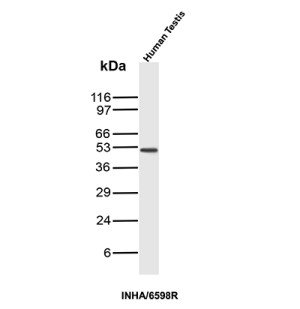 INHA Antibody INHA/6598R Detection in Human Testis by WB. Western blot analysis of human testis tissue lysate using INHA Antibody (clone INHA/6598R) shows a discrete predominant band at approximately 35-40 kDa, with little visible background. This migration is consistent with the glycosylated INHA precursor, which has a theoretical molecular weight of approximately 40 kDa before proteolytic processing into mature inhibin subunits. The clean predominant band demonstrates detection of inhibin alpha in human testis lysate using this Inhibin Alpha Monoclonal Antibody.