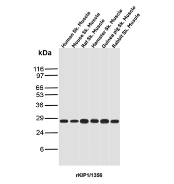 p27Kip1 Antibody Multi-Species Skeletal Muscle WB. Western blot analysis of p27Kip1 / CDKN1B expression across skeletal muscle lysates from multiple species using p27Kip1 antibody clone rKIP1/1356. Lane 1: human skeletal muscle lysate, Lane 2: mouse skeletal muscle lysate, Lane 3: rat skeletal muscle lysate, Lane 4: hamster skeletal muscle lysate, Lane 5: guinea pig skeletal muscle lysate, Lane 6: rabbit skeletal muscle lysate. A band is detected at approximately 27-29 kDa, consistent with the predicted molecular weight of p27Kip1 (CDKN1B), a cyclin-dependent kinase inhibitor that regulates cell cycle progression. The consistent signal across species supports the use of this clone for broad western blot validation in skeletal muscle samples.