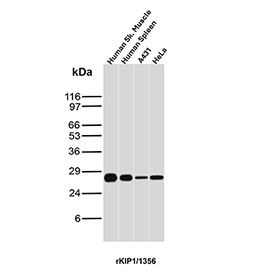 p27Kip1 Antibody Tissue and Cell Line WB. Western blot analysis of p27Kip1 / CDKN1B expression in human tissue and cell lysates using p27Kip1 antibody clone rKIP1/1356. Lane 1: human skeletal muscle lysate, Lane 2: human spleen lysate, Lane 3: A431 cell lysate, Lane 4: HeLa cell lysate. A band is detected at approximately 27-29 kDa, consistent with the predicted molecular weight of p27Kip1 (CDKN1B), a key inhibitor of cyclin-dependent kinases. Detection across normal tissue and cultured cell samples supports the use of this clone for broad western blot validation across diverse sample types.