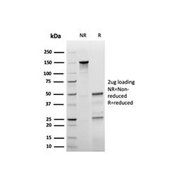 SDS-PAGE analysis of purified, BSA-free recombinant p27Kip1 antibody (clone rKIP1/1356) as confirmation of integrity and purity.