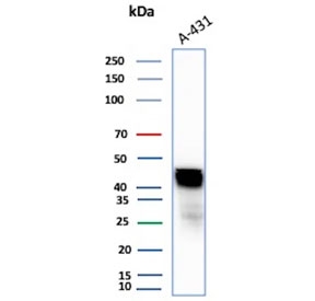 Western blot testing of human A431 cell lysate with Cytokeratin 17 antibody. Predicted molecular weight ~48 kDa.