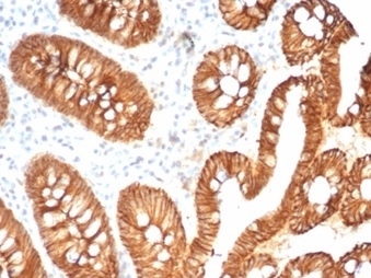 CDH1 Antibody Human Colon IHC. Immunohistochemistry analysis of Cadherin 1 / CDH1 expression in FFPE human colon tissue using clone CDH1/7034R antibody, showing strong membranous HRP-DAB brown staining in epithelial cells lining glandular structures with clear cell-cell junction localization, while surrounding stromal tissue remains largely negative. HIER: boil tissue sections in pH 9 10mM Tris with 1mM EDTA for 20 min and allow to cool before testing. Signal highlights epithelial organization and regulated cell adhesion within colon mucosa.