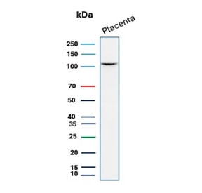 CDH1 Antibody human placental tissue WB. Western blot analysis of Cadherin 1 / CDH1 expression using clone CDH1/7034R antibody, showing a band near the predicted molecular weight of E-cadherin. E-cadherin is synthesized as a precursor and undergoes glycosylation, resulting in an apparent molecular weight typically observed between approximately 80-120 kDa, with the precursor form near 135 kDa. The detected band is consistent with mature glycosylated CDH1 expressed in placental epithelial tissue.