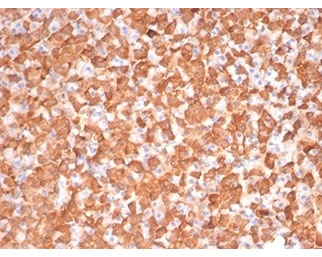 PRKCI Antibody / Atypical Protein Kinase C Antibody Dog Liver IHC. Immunohistochemical staining of FFPE dog liver tissue using PRKCI Antibody / Atypical Protein Kinase C Antibody, clone PRKCI/4911. PRKCI expression is observed as strong cytoplasmic staining within hepatocytes, consistent with the protein's role as an atypical serine/threonine kinase involved in cell polarity and intracellular signaling. Heat-induced epitope retrieval was performed using pH 9 Tris-EDTA buffer for 20 minutes prior to immunostaining.