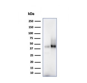 CD38 Antibody human spleen and Raji lysate WB. Western blot analysis of CD38 / plasma cell marker expression in human spleen tissue and Raji cell lysate using CD38 antibody clone CD38/4328. Lane 1: human spleen lysate, Lane 2: human Raji cell lysate. A band is detected at approximately 40-45 kDa, consistent with the predicted molecular weight of CD38, with higher apparent molecular weight reflecting glycosylation of this cell surface protein and aligning with expression in immune cell-rich tissues and B cell-derived lines.