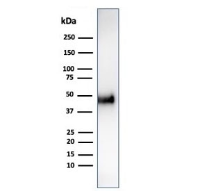 Western blot testing of human HCT-116 cell lysate using CCNE1 antibody (clone CCNE1/4935R). Predicted molecular weight ~47 kDa.