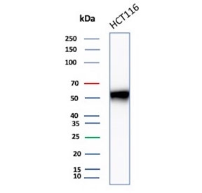Western blot testing of human HCT-116 cell lysate using recombinant CCNE1 antibody (clone CCNE1/4935R). Predicted molecular weight ~47 kDa.