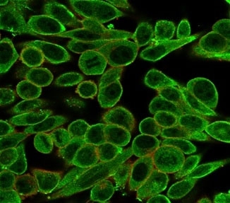 MED21 Antibody HeLa Cell IF. Immunofluorescent staining of PFA-fixed human HeLa cells using MED21 Antibody (green, clone PCRP-MED21-4B5) with phalloidin cytoskeletal counterstain (red). MED21 Antibody, a Transcription Mediator Complex Antibody, demonstrates nuclear and cytoplasmic staining in HeLa cells, consistent with MED21 function as a Mediator complex subunit involved in RNA polymerase II transcriptional regulation, chromatin-associated gene expression, and control of transcriptional programs.