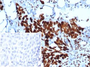 Recombinant MSH6 Antibody MSH6/6654R in Human Esophagus IHC. Immunohistochemistry testing of Recombinant MSH6 Antibody, clone MSH6/6654R, in FFPE human esophagus tissue. Strong nuclear staining is observed in epithelial cells, consistent with the nuclear localization of MSH6. The inset shows a secondary-only negative control in which PBS was substituted for the primary antibody, demonstrating minimal background staining under the tested conditions.